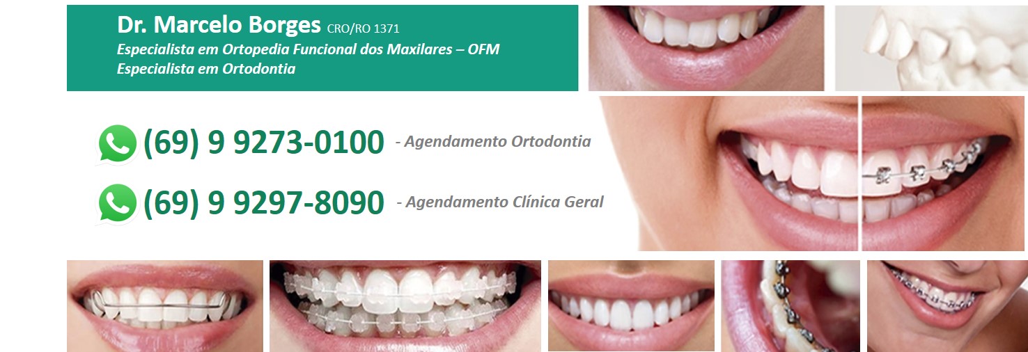 Dr Marcelo Borges – Ortodontia